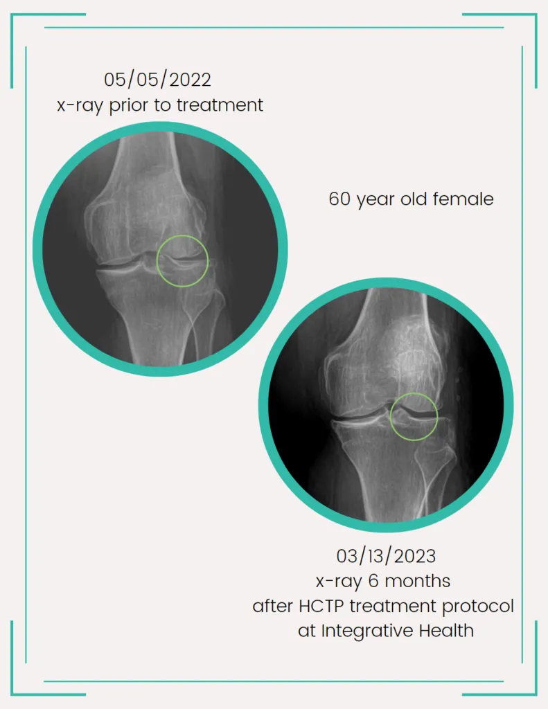 knee pain clinic
